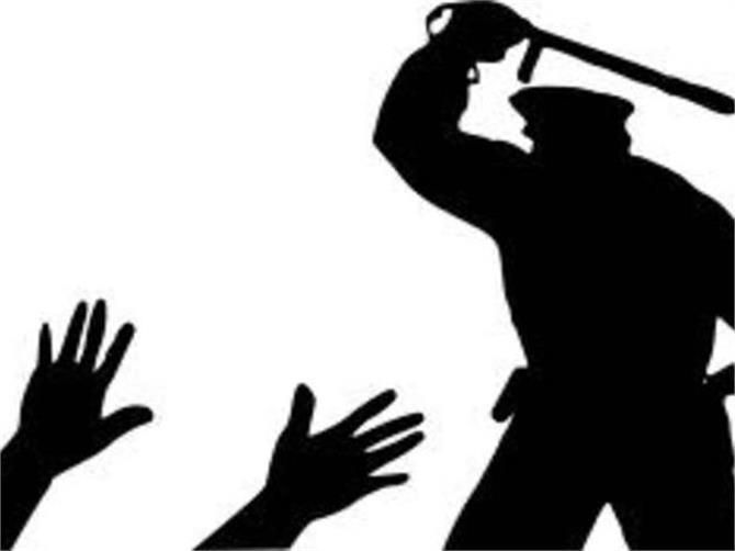 Police Brutality, Excessive Force, Criminal Lawyers
